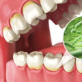 What is teeth cleaning called?