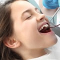 Is professional teeth cleaning necessary?