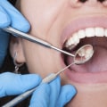 How much are dental cleanings nyc?